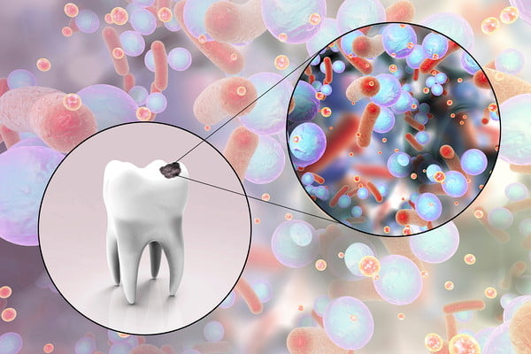 歯に潜む細菌のイメージ